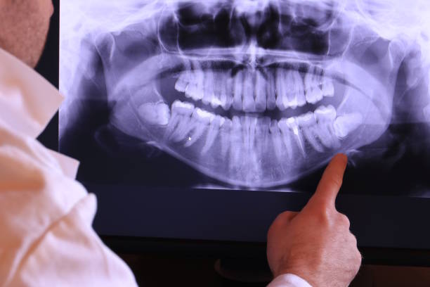 Best Emergency Gum Treatment in Grapevine, TX