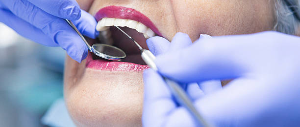 Best Emergency Dental Care for Broken or Chipped Teeth in Grapevine, TX